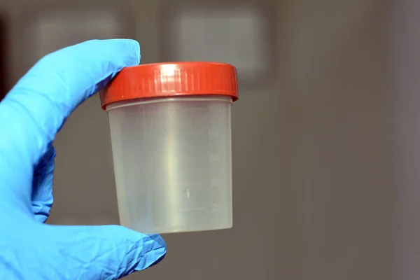 Plastikowy Pojemnik Badania Moczu Analizy Laboratoryjnej Moczu Test Wykrywania Leczenia — Zdjęcie stockowe