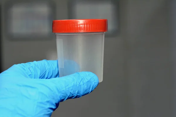 Plastikowy Pojemnik Badania Moczu Analizy Laboratoryjnej Moczu Test Wykrywania Leczenia — Zdjęcie stockowe