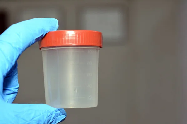 Contenitore Analisi Delle Urine Plastica Analisi Laboratorio Test Rilevare Gestire — Foto Stock