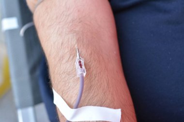 Kan bağışı, gönüllü kan bağışı, damar içi bir damar yolu hayır kurumu için kan torbası toplama, talasemi ve diğer hastalıklara sahip çocuklar, bir hayat konseptini kurtarmak için, dünya kan bağışı günü.