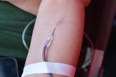 Kan bağışı, gönüllü kan bağışı, damar içi bir damar yolu hayır kurumu için kan torbası toplama, talasemi ve diğer hastalıklara sahip çocuklar, bir hayat konseptini kurtarmak için, dünya kan bağışı günü.