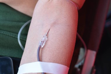 Kan bağışı, gönüllü kan bağışı, damar içi bir damar yolu hayır kurumu için kan torbası toplama, talasemi ve diğer hastalıklara sahip çocuklar, bir hayat konseptini kurtarmak için, dünya kan bağışı günü.