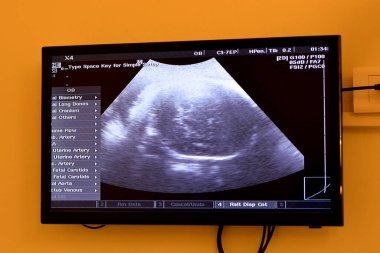 Hamile bir kadının rahminde ultrasonografi sağlıklı bir fetüs, hamilelik sırasında anne ultrasonu, gebelik ve fetüs sağlığı konsepti, ultrasonogram sağlık kontrolü.