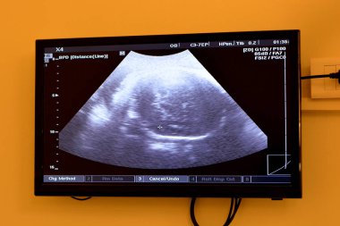 Hamile bir kadının rahminde ultrasonografi sağlıklı bir fetüs, hamilelik sırasında anne ultrasonu, gebelik ve fetüs sağlığı konsepti, ultrasonogram sağlık kontrolü.