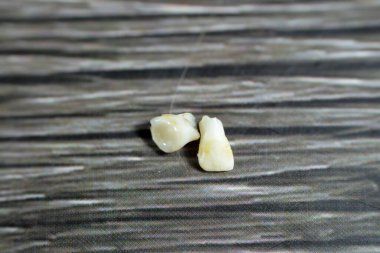 Yapay birincil bebek geçici dişleri, insanların gelişimi ve büyümesindeki ilk dişler, genellikle kaybolur ve kalıcı dişlerle yer değiştirir, embriyonik safhada oluşmaya başlarlar.