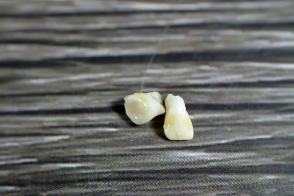 Deciduous primary baby temporary teeth, the first set of teeth in the growth and development of humans, They are usually lost and replaced by permanent teeth, they start to form during embryonic phase