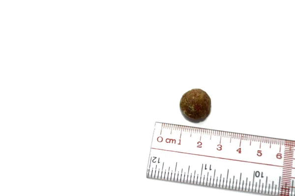 Duży Kamień Żółciowy Usunięty Chirurgicznie Laparoskopowej Cholecystektomii Kamienie Żółciowe Utwardzane — Zdjęcie stockowe
