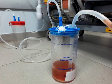 Kahire, Mısır, 2 Ağustos 2023: Ghatwary tıbbi göğüs şişesi 2000 ml, bir göğüs tüpü aspirasyon pnömonisi vakasından alınan drenaj plevral efüzyon ve empyema, sıvı cerahat, lif ve kanla sonuçlandı