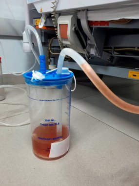 Kahire, Mısır, 2 Ağustos 2023: Ghatwary tıbbi göğüs şişesi 2000 ml, bir göğüs tüpü aspirasyon pnömonisi vakasından alınan drenaj plevral efüzyon ve empyema, sıvı cerahat, lif ve kanla sonuçlandı