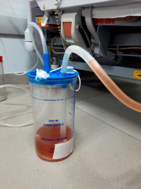 Kahire, Mısır, 2 Ağustos 2023: Ghatwary tıbbi göğüs şişesi 2000 ml, bir göğüs tüpü aspirasyon pnömonisi vakasından alınan drenaj plevral efüzyon ve empyema, sıvı cerahat, lif ve kanla sonuçlandı