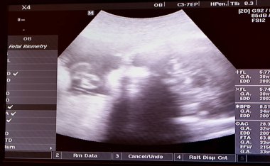Hamile bir kadının rahminde ultrasonografi sağlıklı bir fetüs, hamilelik sırasında anne ultrasonu, gebelik ve fetüs sağlığı konsepti, ultrasonogram sağlık kontrolü.