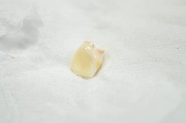 Kaybedilmiş birincil bebek geçici dişi, insanların büyüme ve gelişimindeki ilk diş seti, genellikle kaybolur ve kalıcı dişlerle değiştirilir.