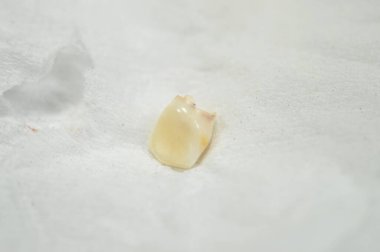 Kaybedilmiş birincil bebek geçici dişi, insanların büyüme ve gelişimindeki ilk diş seti, genellikle kaybolur ve kalıcı dişlerle değiştirilir.