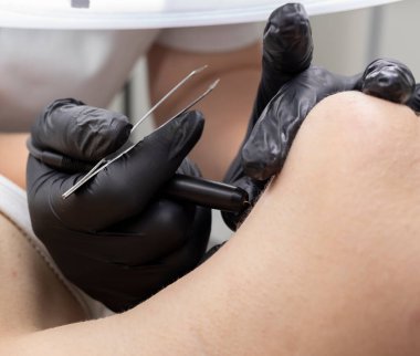 Dermatolog, kadının boynunda elektroliz tedavisi yapıyor. Güzellik Salonunda Elektrik Epilasyonu, Tanınmayan Hasta. Yatay düzlem. Otantik Yüksek Kaliteli Fotoğraf