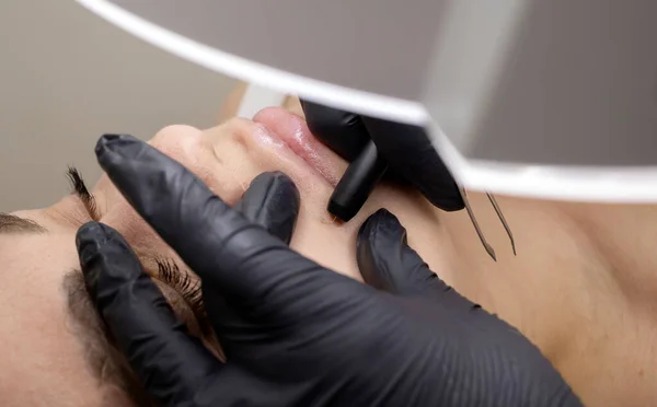 Dermatolog, kadının yüzündeki kılları elektroliz ile temizledi. Güzellik Salonunda Elektrik Epilasyonu, Tanınmayan Hasta. Yatay düzlem. Otantik Yüksek Kalite Fotoğraf