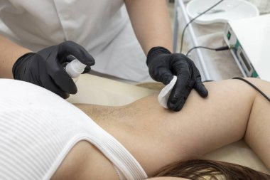 Kırpılmış Elektrolog Güzellik Salonundaki Tıbbi Elektroliz Cihazı ile Kılları Çıkarmadan Önce Koltuk Altını Dezenfekte Ediyor. Yatay düzlem. Saç Temizleme Tedavisi. Yüksek kalite fotoğraf