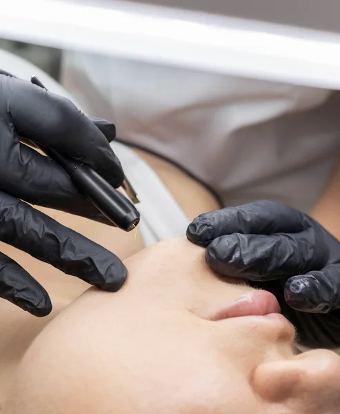 Kapanış dermatoloğu çenesindeki kılları alıyor, müşterilerin çenesi elektroliz prosedürüyle karşı karşıya, Güzellik Salonu 'nda elektrik patlaması. Saç Temizleme Tedavisi. Dikey Düzlem Yüksek Kaliteli Fotoğraf