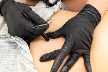 Hirsutizm. Kesilmiş dermatolog kadın göbeğindeki kılları, elektroliz prosedürlü karın bölgesini, güzellik salonundaki elektriksel epilasyonu kaldırdı. Yatay düzlem. Otantik Fotoğraf