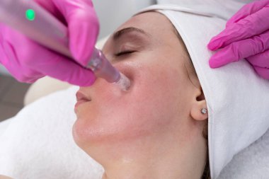 Closeup Cosmetologist Making Mesotherapy Injection With Dermapen On Face, Cheek Area Of Young Woman For Rejuvenation In Spa Center. Patient Getting Needle Mesotherapy, Skincare. Horizontal Plane. clipart