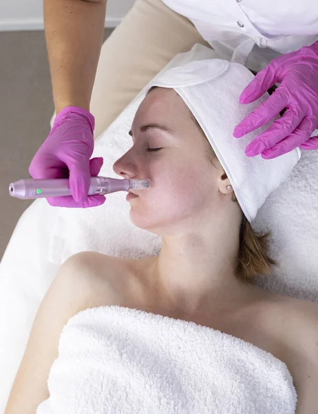 Closeup Cosmetoloog Het Maken Van Mesotherapie Injectie Met Dermapen Het Stockfoto