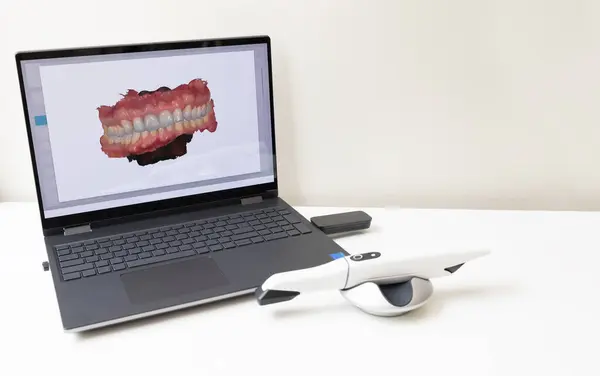 3D Scanned Picture of Scanned Teeth on Monitor of Computer, Notebook. White 3d Intraoral Dental Tooth Scanner Lying on Table. Copy Space. Dental Equipment, Device For Scanning Teeth. Horizontal Plane