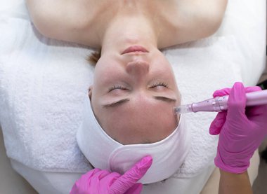 Üst düzey hasta iğne terapisi görüyor, Cilt bakımı. Anestezi uzmanı yüzüne dermapen iğnesi yapıyor, kaplıcadaki gençleştirme için genç bir kadının alın bölgesi. Yatay Düzlem.