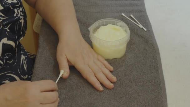 女人用含羞草的指甲用药物治疗她的手 — 图库视频影像