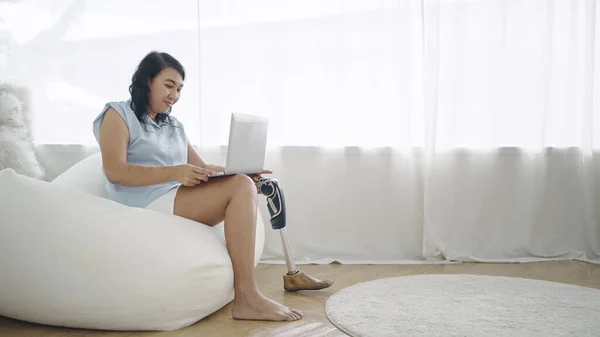 Protez Bacaklı Yetişkin Asyalı Kadınlar Internette Çalışmak Yatak Odasındaki Rahat — Stok fotoğraf
