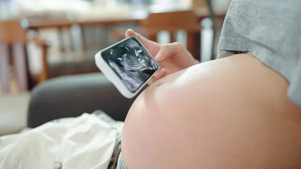 Pregnant women looking ultrasound video her baby on smartphone. Close up ultrasound video on smartphone. Third trimester pregnancy. Gynecology birth childbirth, Pregnancy concept
