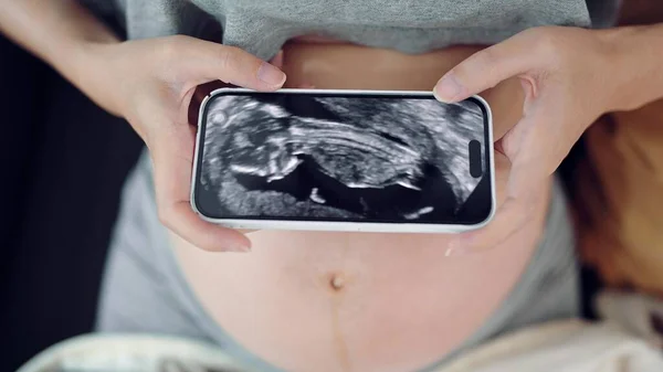 看起来像超声波的孕妇在智能手机上给她的孩子录像 在智能手机上关闭超声波视频 第三个季度怀孕 妇科分娩 怀孕概念 — 图库照片