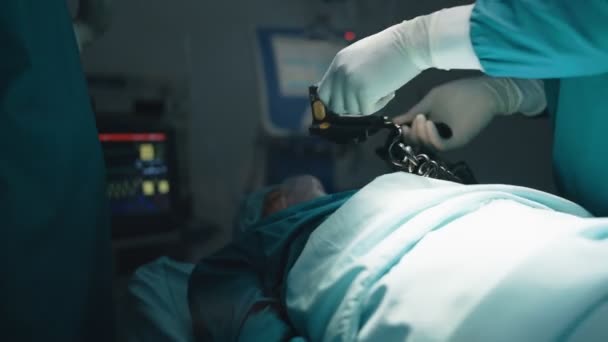 Хірурги Медсестри Допомагають Пацієнтам Інтенсивною Терапією Виробляючи Cpr Використовуючи Дефібрилятори — стокове відео