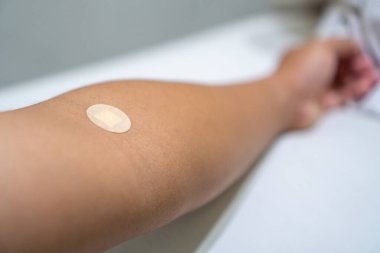 Kanamayı önlemek ve temizliği korumak için kan örneği alındıktan sonra enjeksiyon yerine tıbbi bir bandaj yerleştirilir. Elinizdeki tıbbi bandı kapatın..