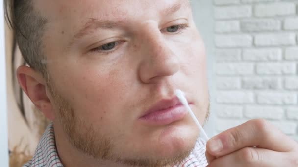 Een Jongeman Wrijft Zalf Een Wond Zijn Lip Herpes Lip — Stockvideo