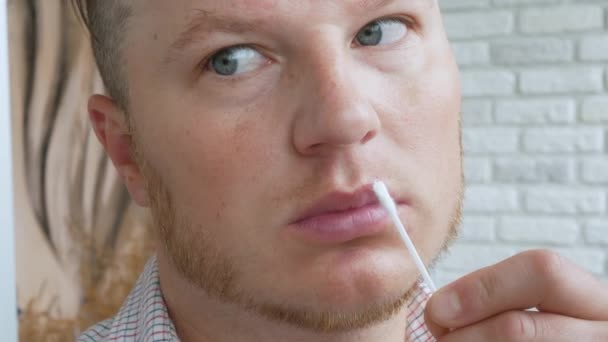 唇に傷を負った若い男が軟膏をこすった 唇の上のヘルペス — ストック動画