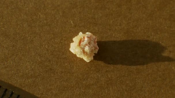 Oxalat Stein Von Oben Aus Der Nähe Einer Menschlichen Niere — Stockvideo