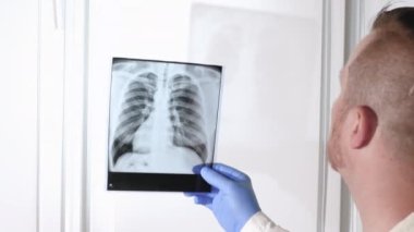 İnsan akciğer röntgeninde tüberküloz. Doktor beyaz arka plandaki akciğerlerin röntgenlerini analiz ediyor. Bir sağlık çalışanı hastanın akciğerlerinin röntgenini inceler. Zatürree