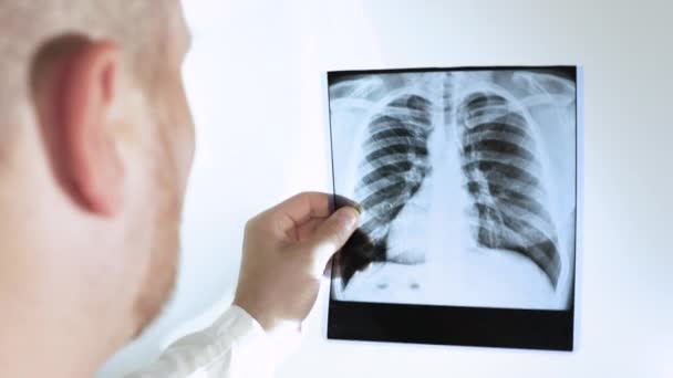 結核は人間の肺のX線で 医者は白い背景で肺のX線を分析する 手の肺の医療従事者X線 写真の肺炎は — ストック動画