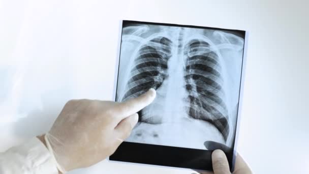 在人类肺X光片上对肺结核进行了密切观察 医生在白色背景下分析肺的X光检查 医务工作者正在对手上的肺进行X光检查 肺气肿卡 — 图库视频影像