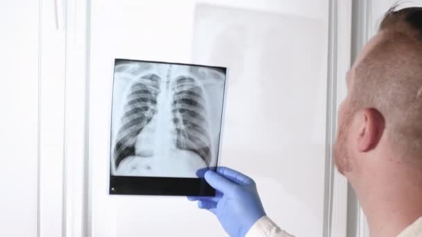 Φυματίωση Ανθρώπινη Ακτίνα Πνευμόνων Γιατρός Αναλύει Την Ακτινογραφία Των Πνευμόνων — Αρχείο Βίντεο