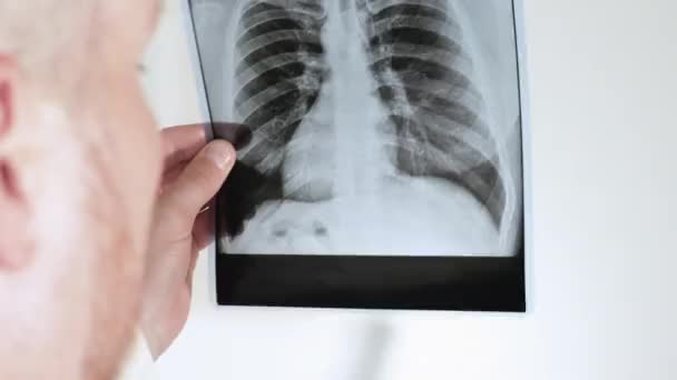 放射学家 一个专家分析一个人在白色背景下的肺部X射线 肺气肿 图片中的鼻青脸肿 — 图库视频影像