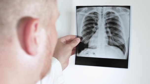 Ακτινολόγος Ένας Ειδικός Αναλύει Μια Ακτινογραφία Των Πνευμόνων Ενός Ατόμου — Αρχείο Βίντεο
