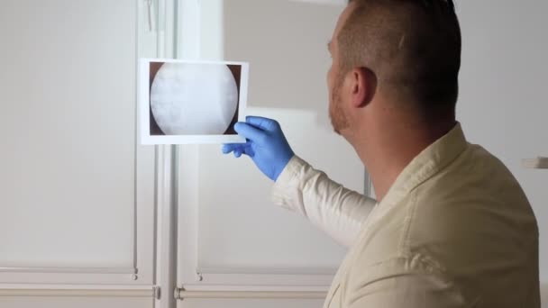 一位医生正在诊断一种疾病 他正在检查他办公室里的X光检查 一位在医院里有经验的医生在仔细检查用石头做的肾部X光检查 X射线上的草酸石 — 图库视频影像