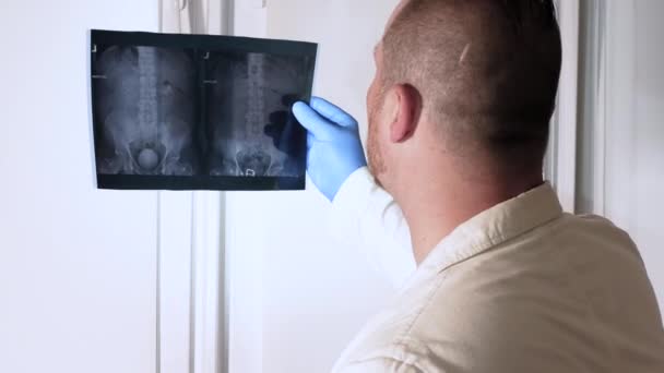 網膜を見る病気の診断をする医師 病院の経験豊富な医師は慎重に石で腎臓のX線を見ています オキサレート石X線 — ストック動画