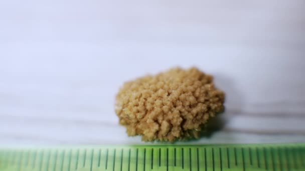 人体肾结石特写 从人体肾中提取的草酸石1 5厘米 — 图库视频影像
