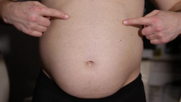 太りすぎの男は大きな腹を示しています 腹部は脂肪で過成長した 体重の問題 若い男の肥満 — ストック動画