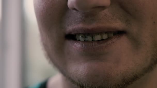 汚い歯の男の恐ろしい笑顔 歯科衛生の概念 男は黒いコーティングで汚れた歯を示しています — ストック動画