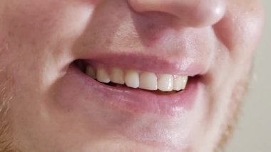 Adam neşeli bir şekilde gülümsüyor. İnanılmaz sevimli erkek gülüşü yakından. Adam güzel beyaz dişler gösteriyor. Dişçide dişlerini yeniledikten sonra. Diş sağlığı konsepti
