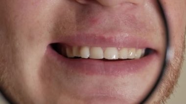 Mükemmel beyaz dişleri olan bir adam. Yenilendikten sonra dişler. Sağlıklı beyaz bakımlı diş kavramı. Dişçi gülümsemesi. Yakın plan.