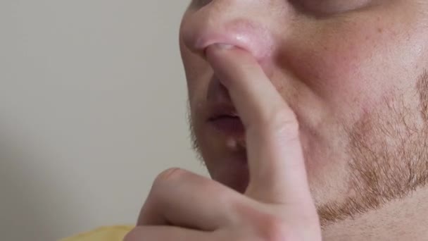 Muž Blízka Prstem Šťourá Nose Vstříkněte Nosu Škodlivé Bakterie Prstem — Stock video