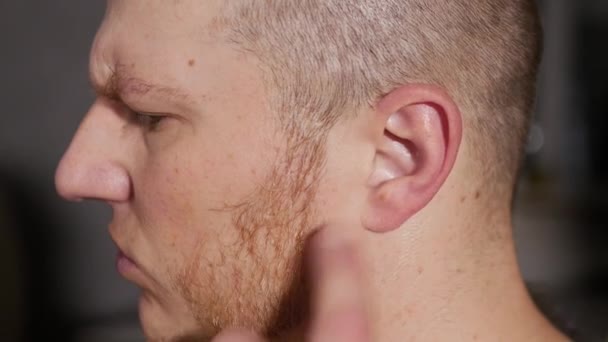Mannen Kliar Sig Örat Med Fingret Ung Man Med Hörselproblem — Stockvideo